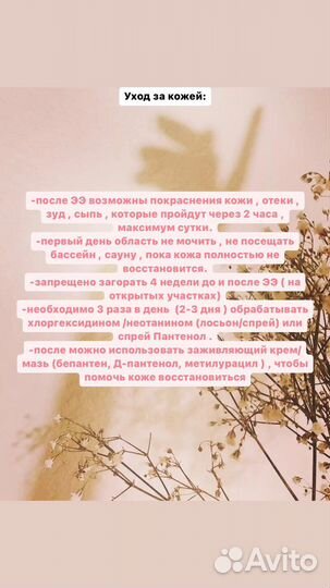 Электроэпиляция