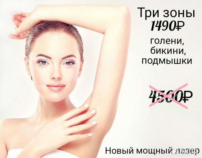 Лазерная эпиляция: голени