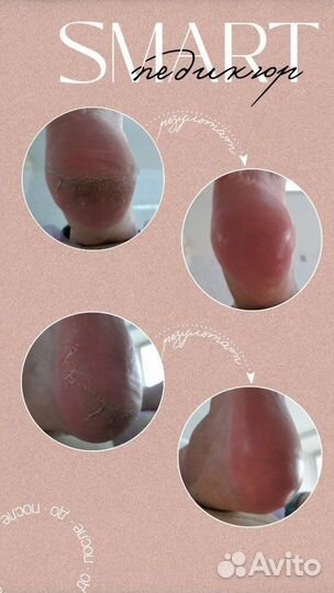 Смарт педикюр