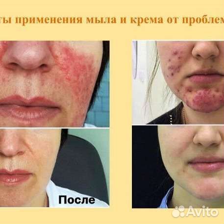 Шунгитовое мыло