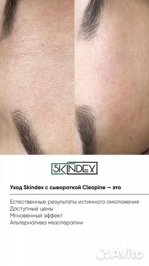 Омоложение лица