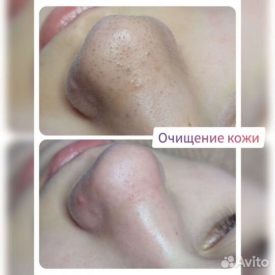 Косметик эстетист