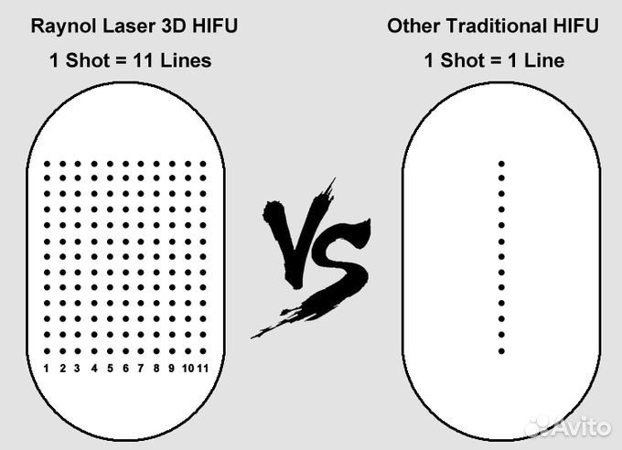 Аппарат hifu 3D smas лифтинг 11 линий