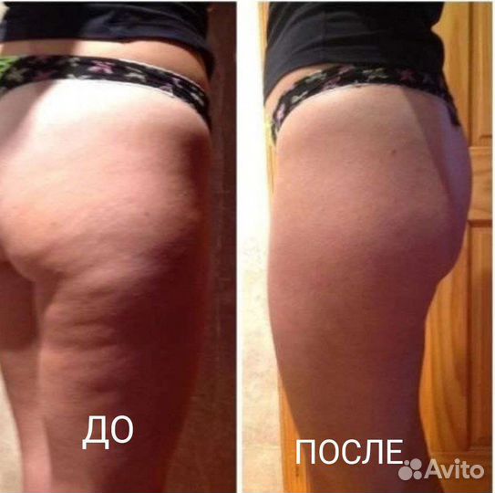 Массаж для женщин- юмр Краснодар