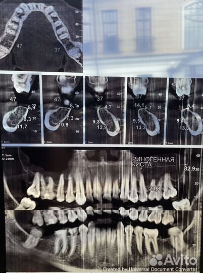 Рентген Принтер sony UP-DF550 термопленочный