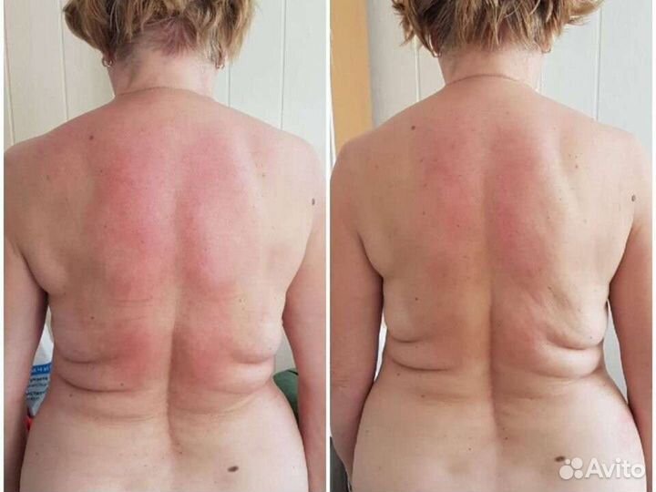 Массаж. Анапа