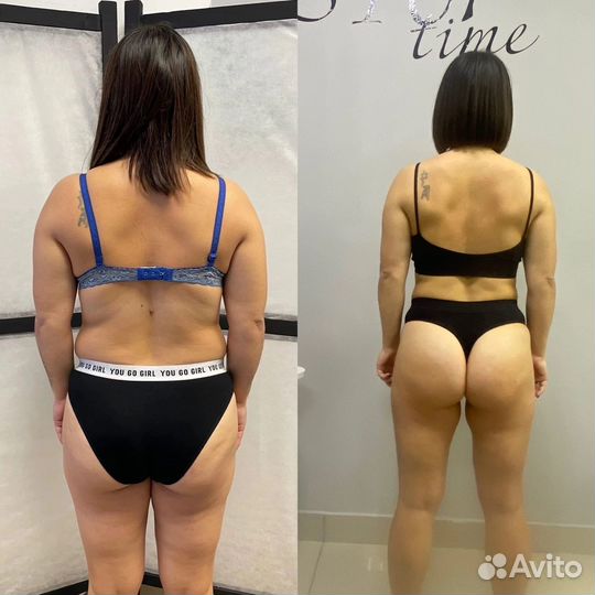 Криолиполиз процедура