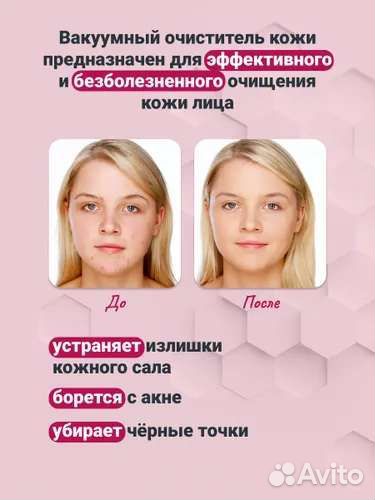 Вакуумный очиститель beauty skin care specialist