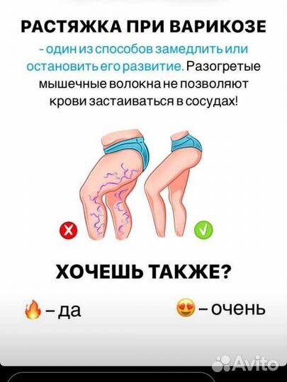 Расстяжка с элементами лфк