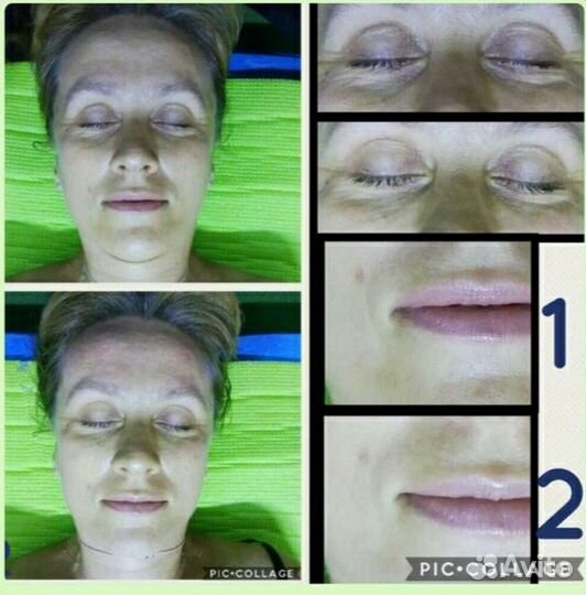 Кинезиолог, массажист, тейпирование