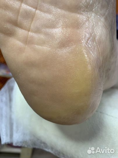 Подолог, педикюр