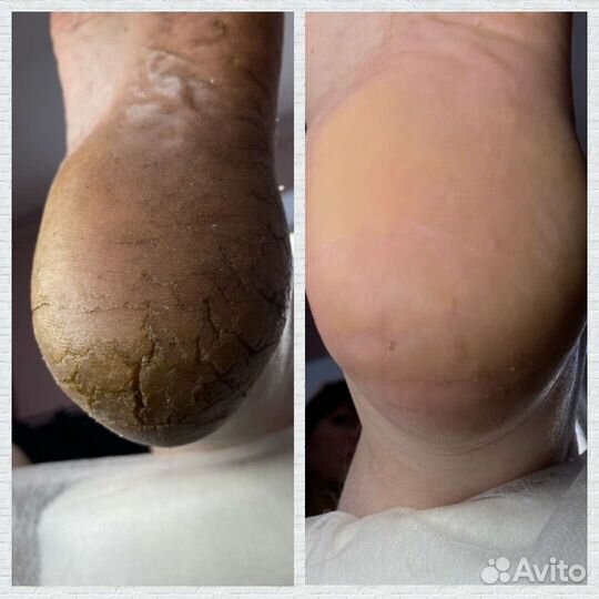 Маникюр и педикюр