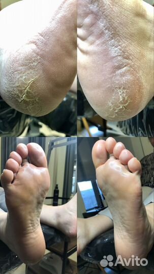 Подология/Педикюр/маникюр/гель лак