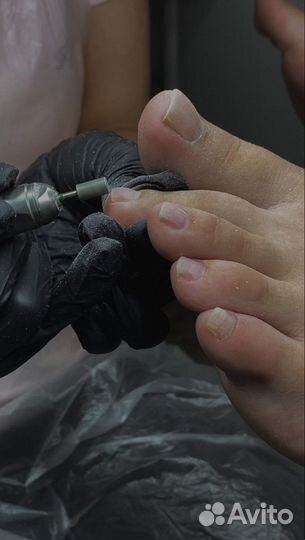 Маникюр - педикюр(подолог)