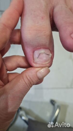 Мастер педикюра подолог