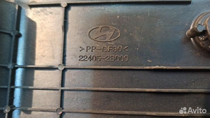 Накладка двигателя декоративная Hyundai Solaris