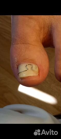 Услуги подолога. Подолог