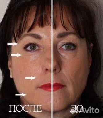 Гальванический спа-прибор против морщин