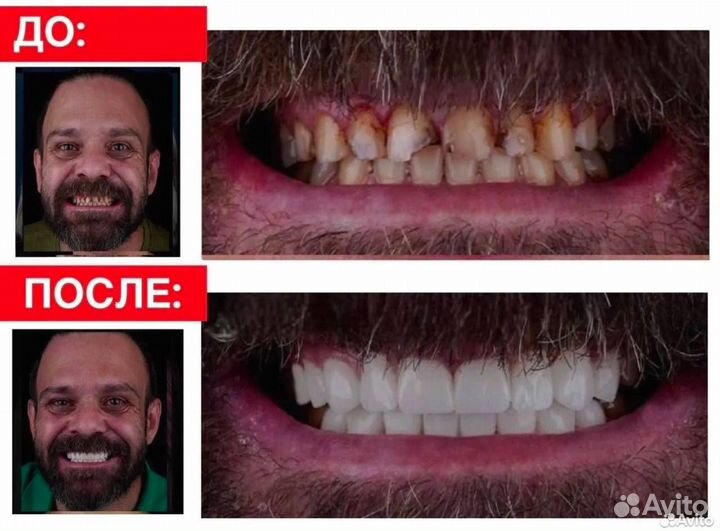 Зубной тур в Турцию. Улыбка за 5 дней