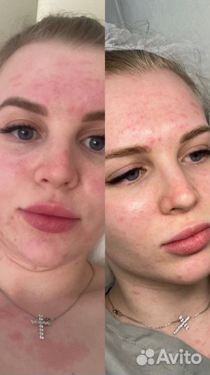 Косметолог эстетист «Крокус»