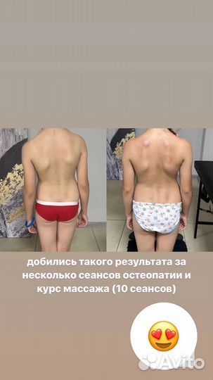 Остеопатия