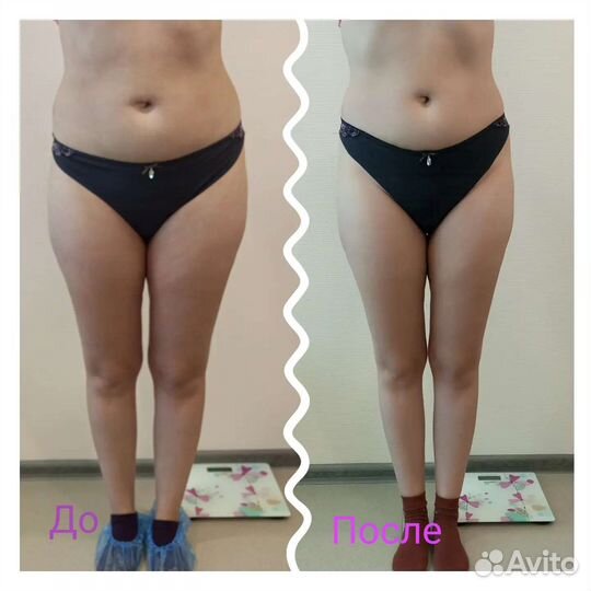 Аппаратный массаж