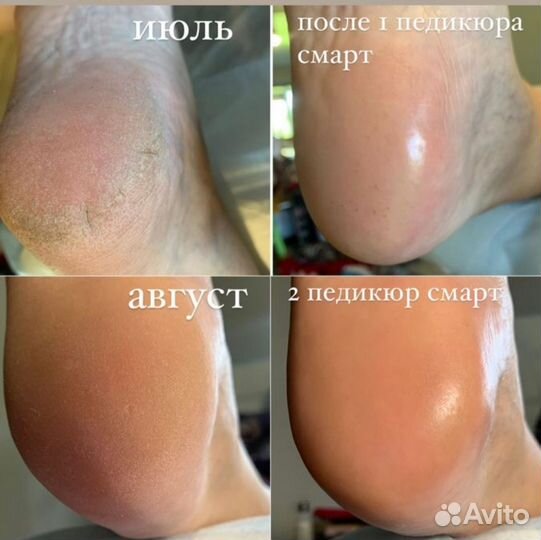 Маникюр, Смарт Педикюр