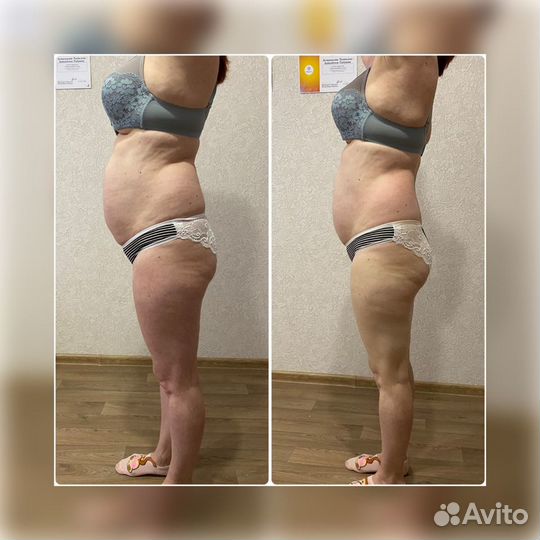 Массаж ручной и аппаратный LPG