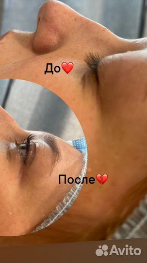 Ламинирование ресниц