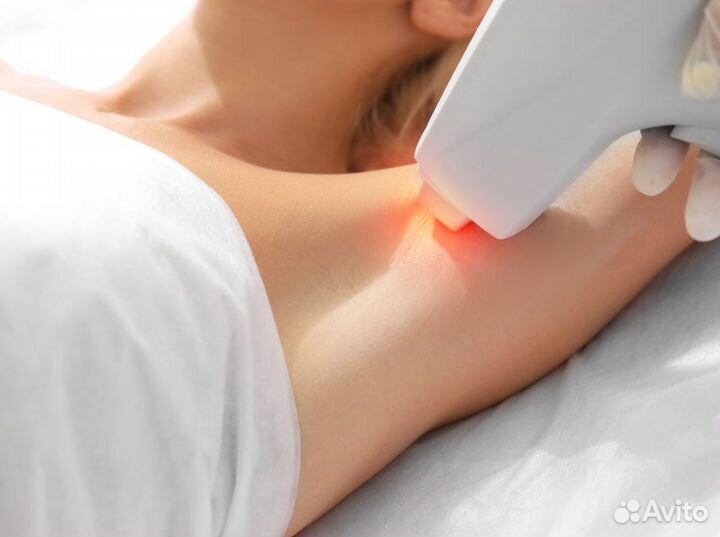 Салон лазерной эпиляции – готовый бизнес