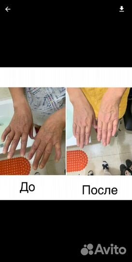 Массаж
