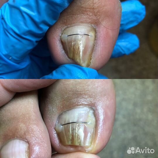 Маникюр педикюр