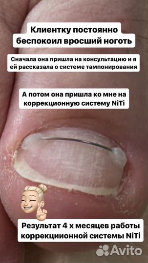Подолог, изготовление стелек