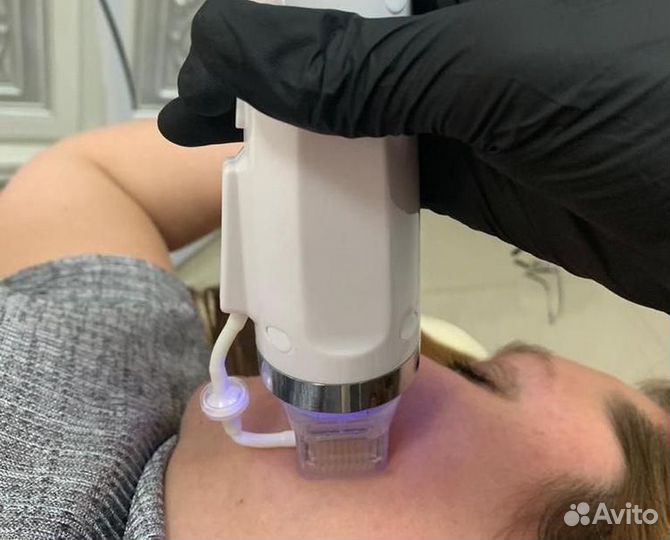 Микроигольчатый РФ лифтинг