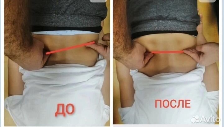 Акупрессура подзатылочных мышц