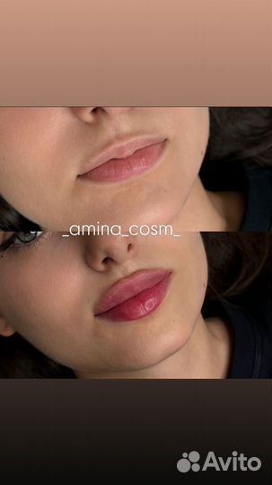 Услуги косметолога