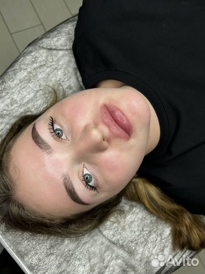 Увеличение губ