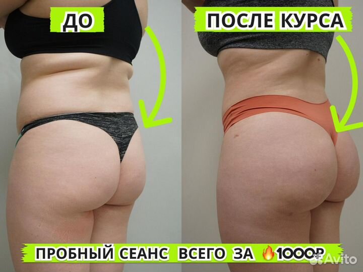 Коррекция фигуры. Изоджей. Гимнастика для ленивых