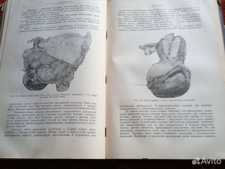 Opitz. Руководство по гинекологии 1928г