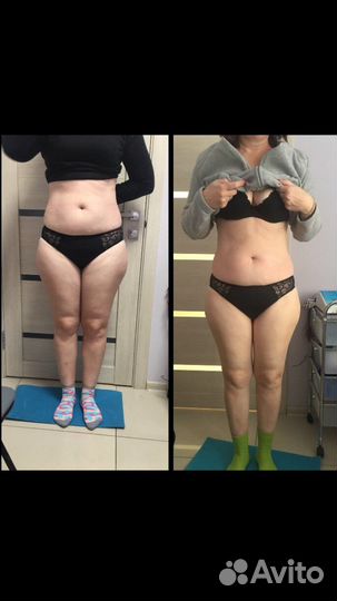 Антицеллюлитный массаж