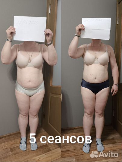 Антицеллюлитный массаж тела