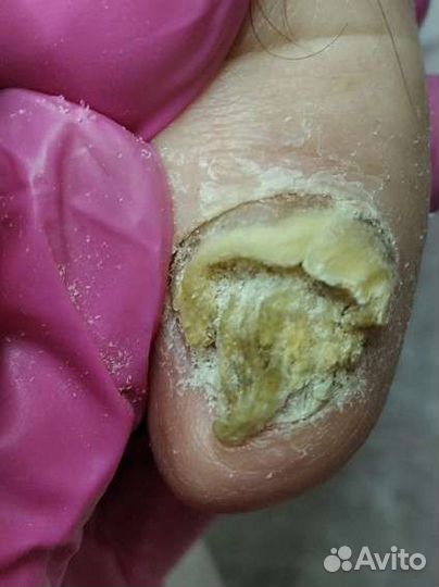 Медицинский педикюр, подолог)