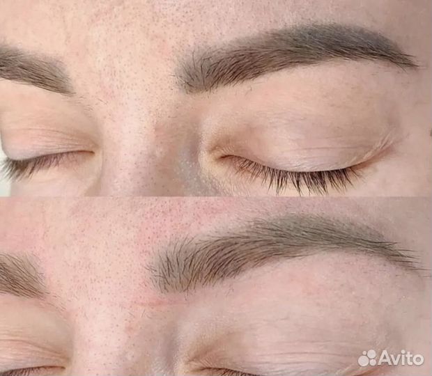 Лазерное удаление татуажа и тату в Москве