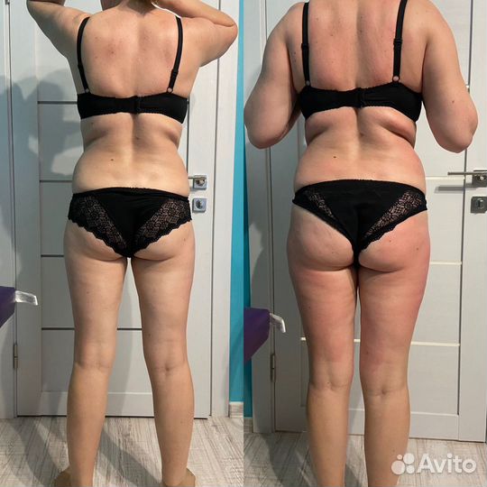 Lpg массаж/вибромассаж G5/кавитация/липолиз/рф