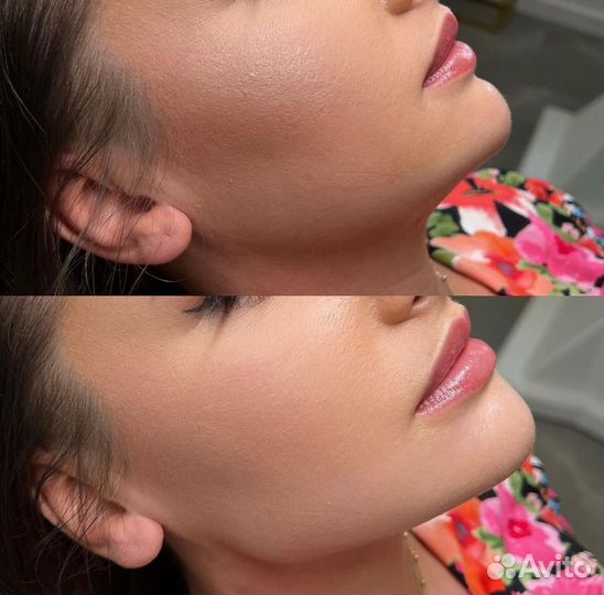 Модели: губы, скулы, профиль Джоли