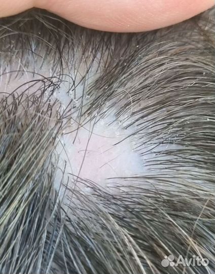 Regaine пенка для женщин против алопеции