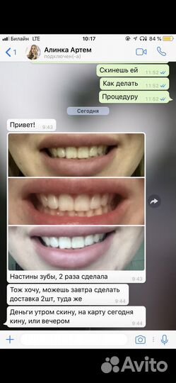 Набор для отбеливания зубов Ivismile