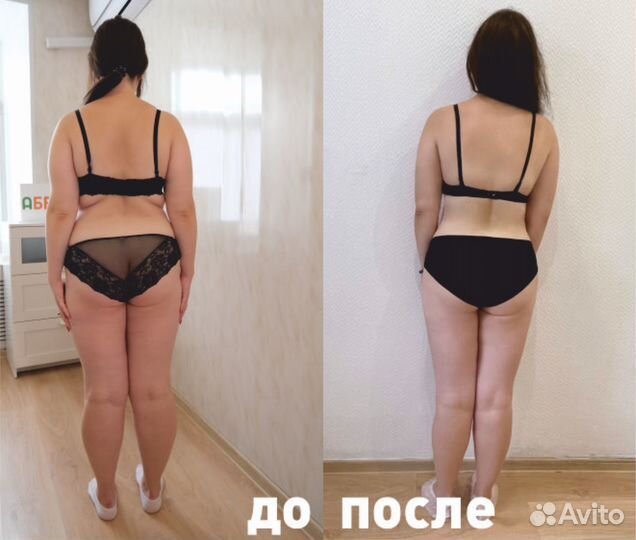 LPG массаж, похудение + лимфодренаж