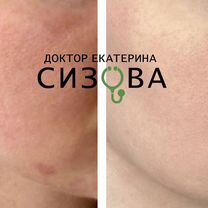 Врач онлайн диетолог, дерматолог, терапевт, пп, Кропивницкий