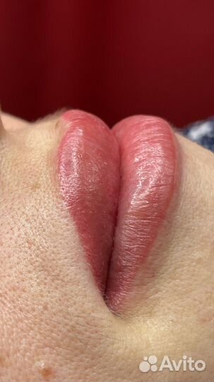 Татуаж, лазерное удаление татуажа и тату